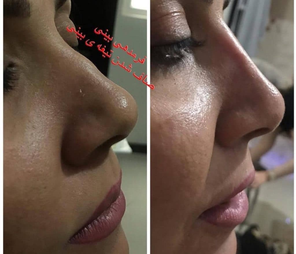 کلینیک زیبایی آرزو در کرج