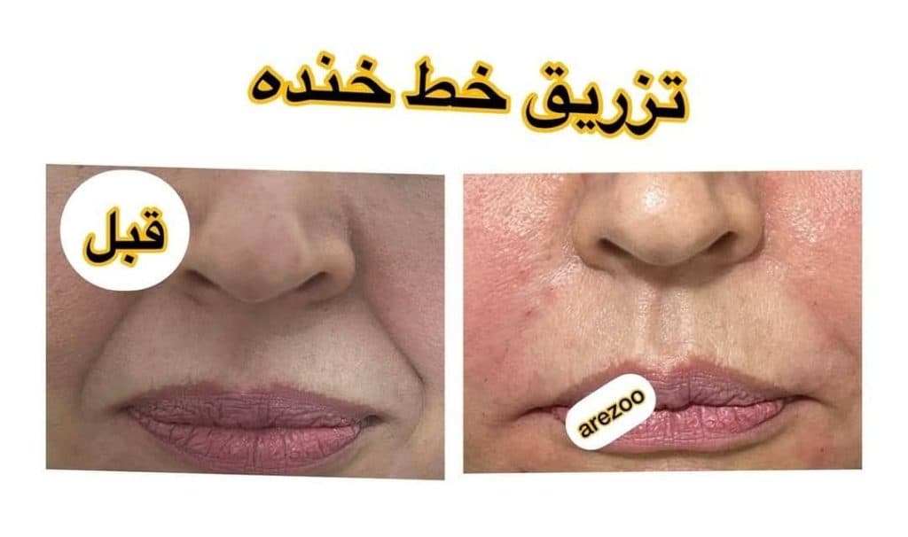 کلینیک زیبایی آرزو در کرج