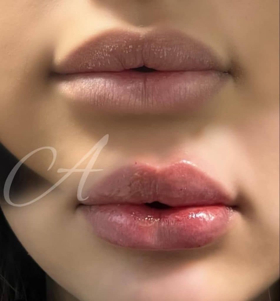 کلینیک زیبایی آرزو در کرج