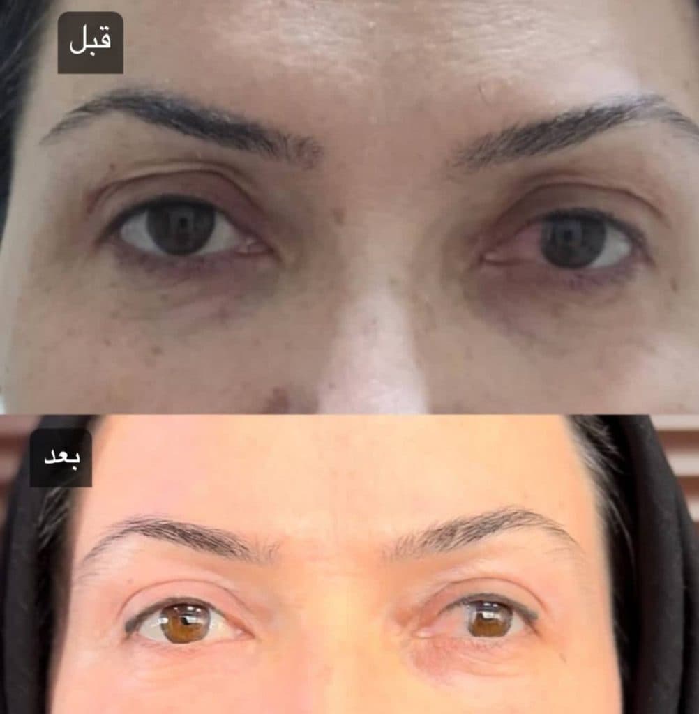 کلینیک زیبایی آرزو در کرج