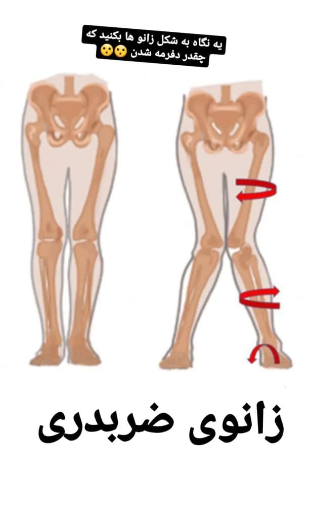 مرکز تخصصی حرکات اصلاحی باشگاه تندرستی در ارومیه