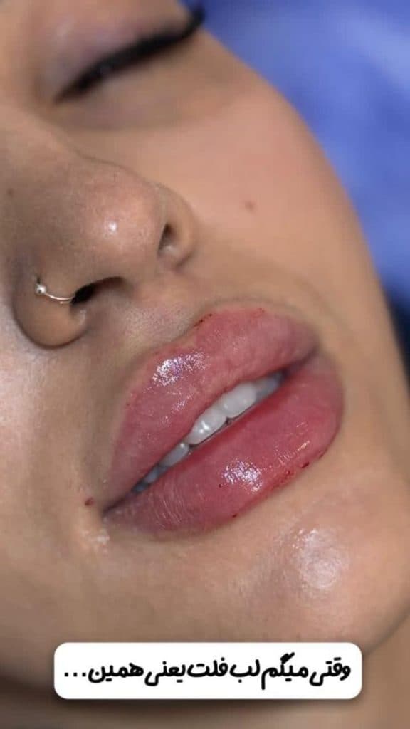 کلینیک زیبایی بهارک جوانی در ستارخان تهران