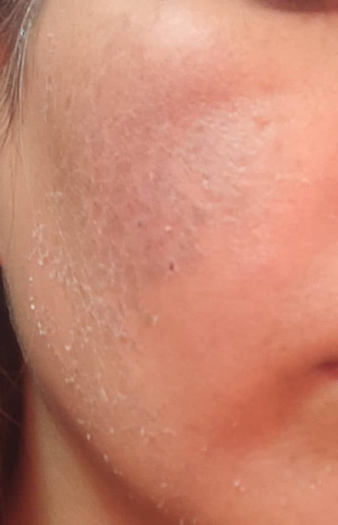 فشیال تخصصی پوست آرتیسا در فسا