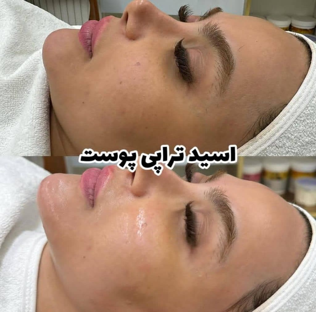 کلینیک مراقبت پوست و مو فتانه هیبدی در اهواز