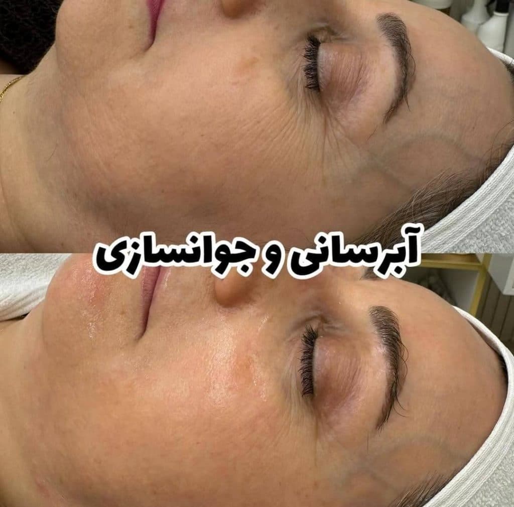 کلینیک مراقبت پوست و مو فتانه هیبدی در اهواز