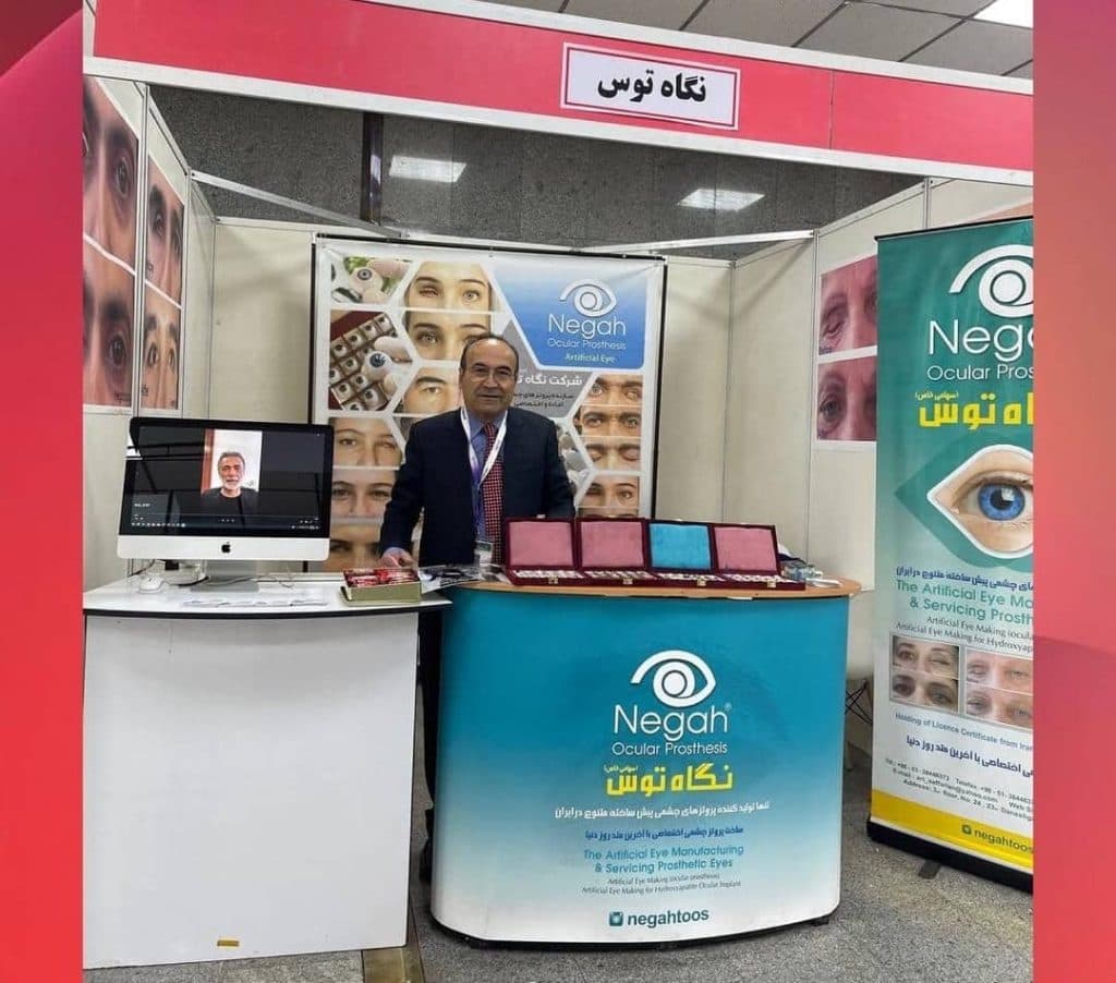 ساخت چشم مصنوعی نگاه توس در مرکز مشهد