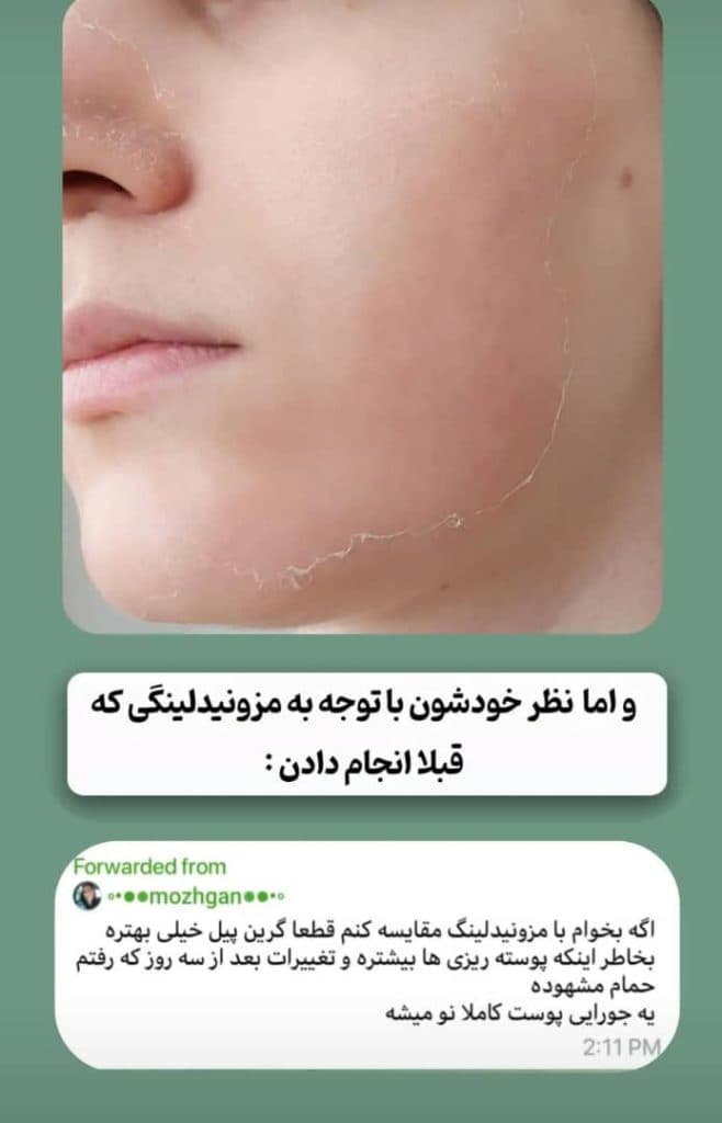 آموزش و خدمات تخصصی گرین پیل و اسپیکیول تراپی نازنین شاهرخی در اراک