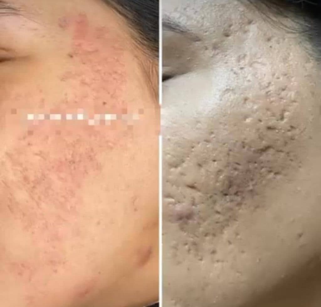خدمات تخصصی فیشیال و پاکسازی پوست آزیتا زارع در صفاییه یزد