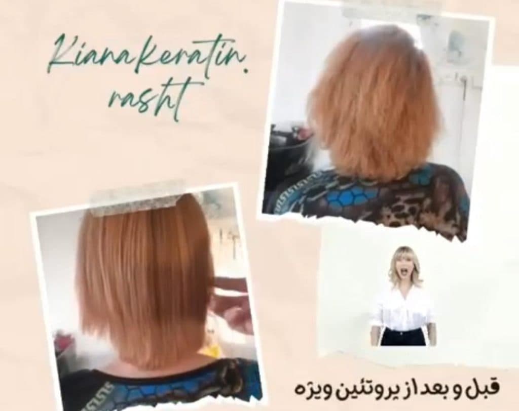 کلینیک دندانپزشکی تیانا در تهرانپارس تهران