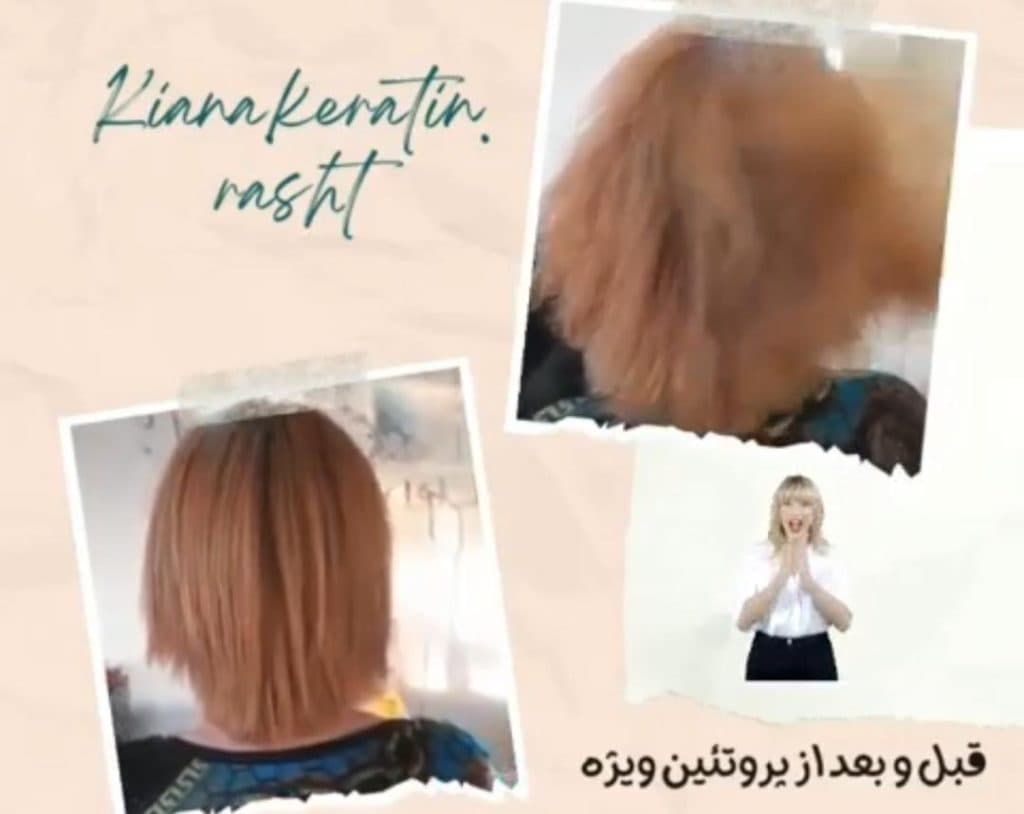 کلینیک دندانپزشکی تیانا در تهرانپارس تهران