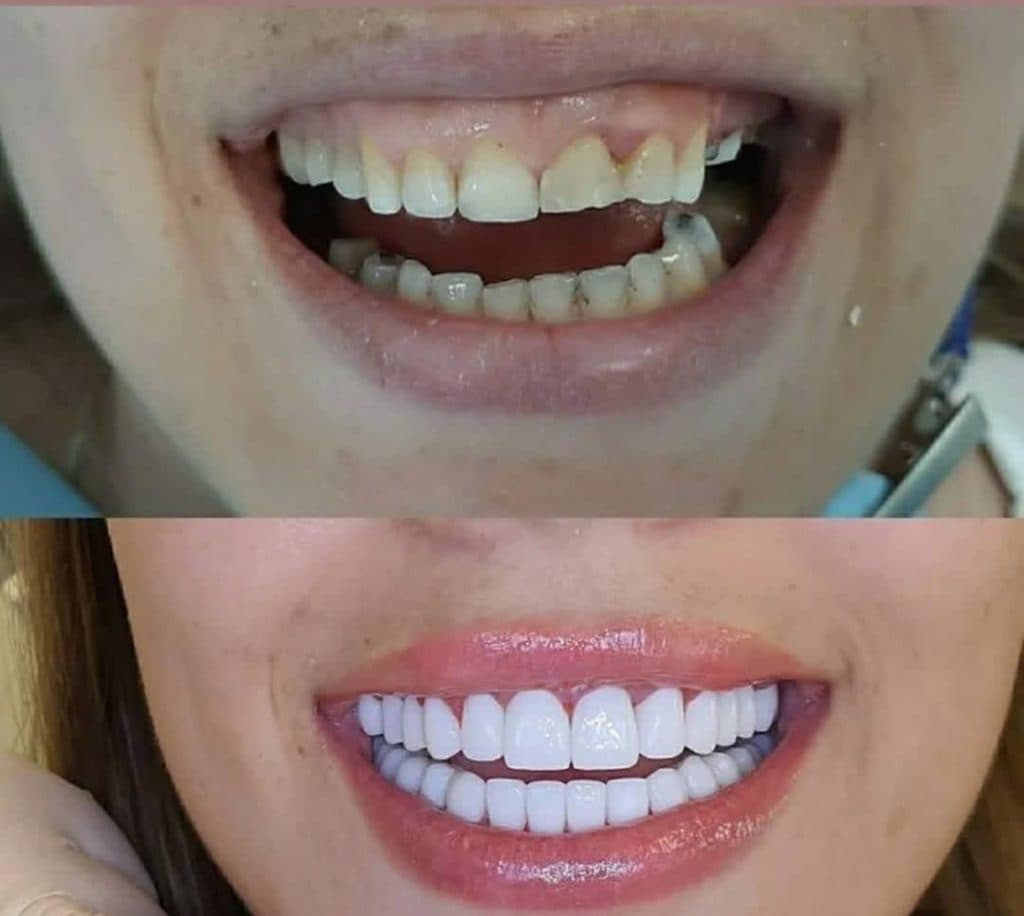 کلینیک دندانپزشکی تیانا در تهرانپارس تهران