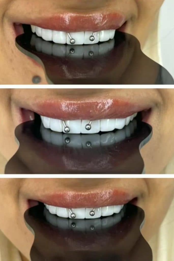 کلینیک دندانپزشکی تیانا در تهرانپارس تهران