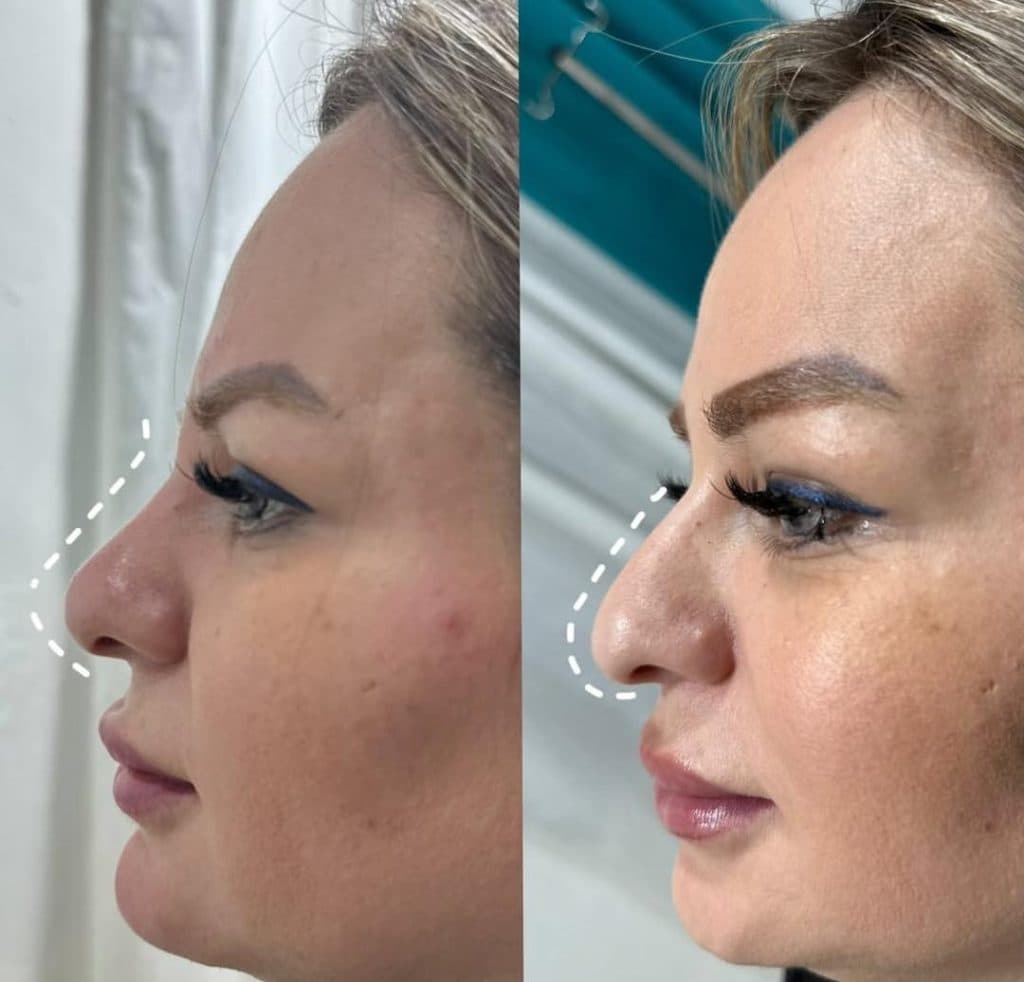 مطب زیبایی و درمانی دکتر مهسا قلی زاده در فاز اول ضیابری رشت