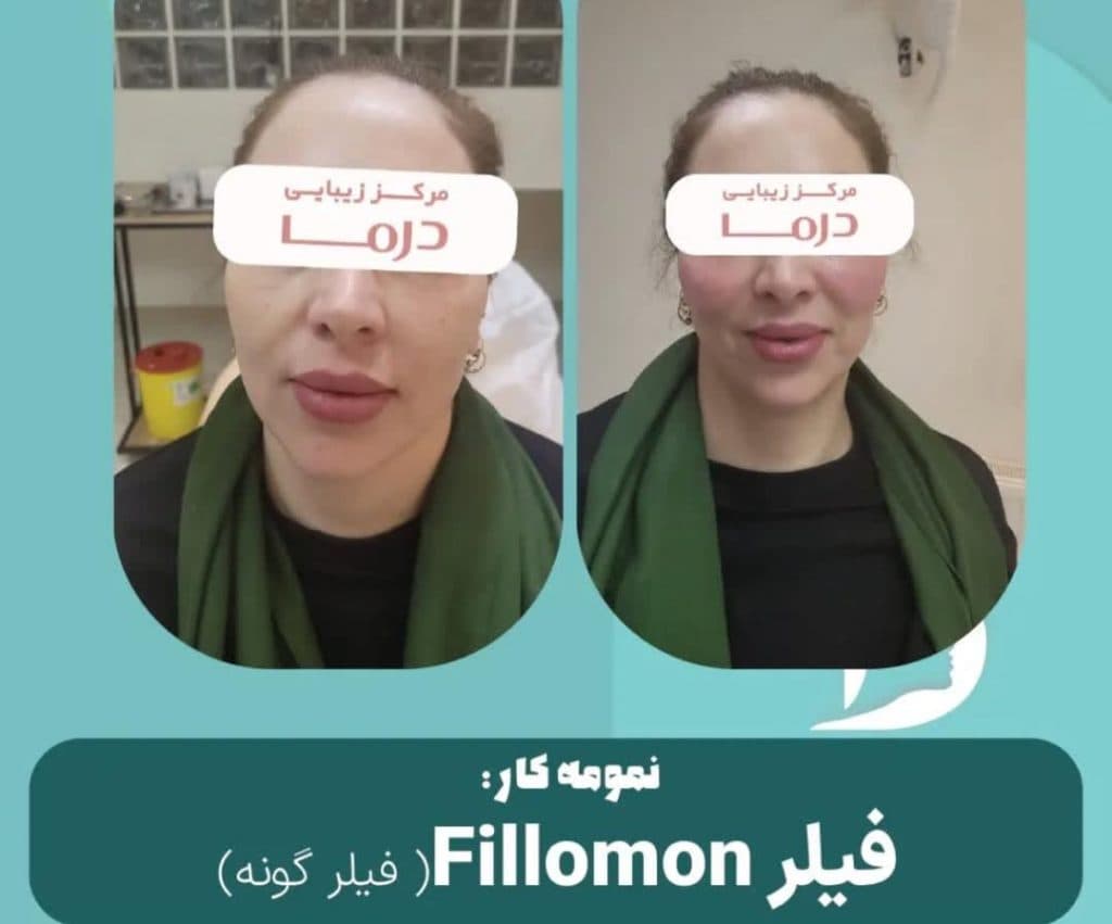 کلینیک زیبایی درما در ولیعصر تبریز