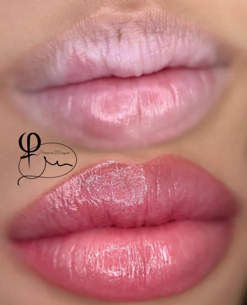 کلینیک زیبایی درما در ولیعصر تبریز