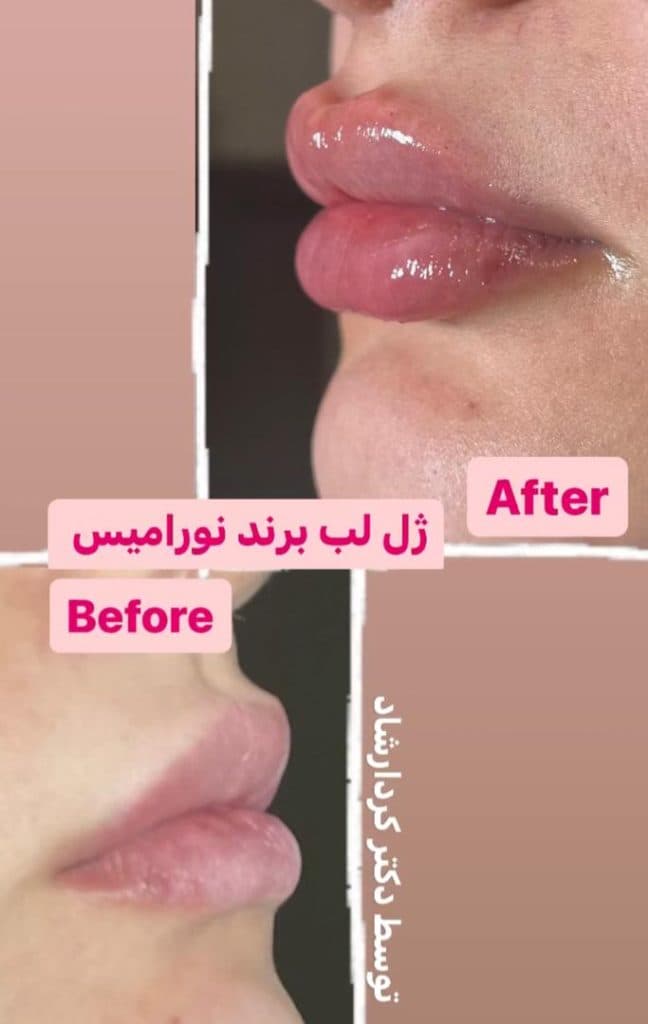 کلینیک زیبایی افرا در قائمیه اسلامشهر