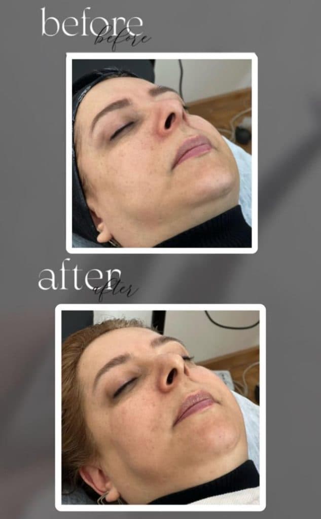 مطب زیبایی روشا در ولیعصر تبریز