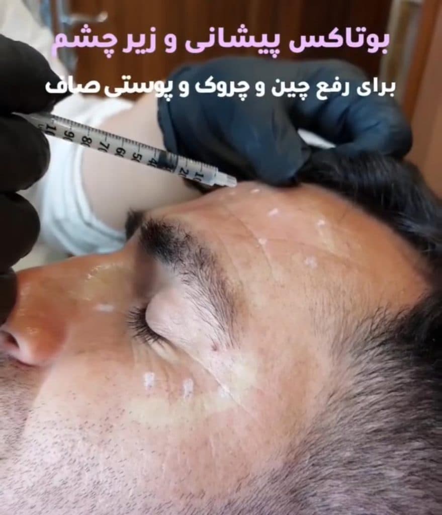 مطب زیبایی روشا در ولیعصر تبریز