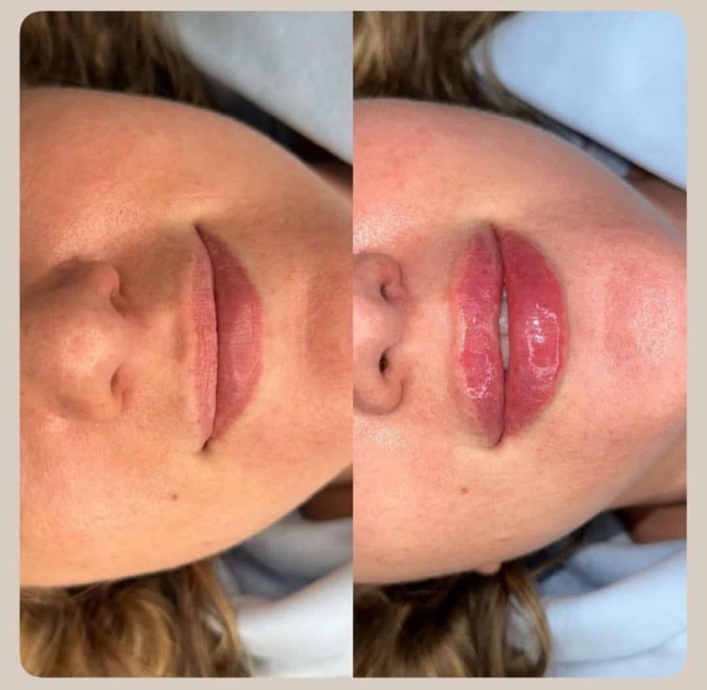 مطب زیبایی روشا در ولیعصر تبریز