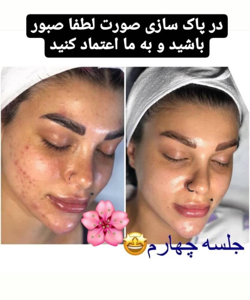 مرکز تخصصی ماساژ و اسپای بامبو در اردبیل