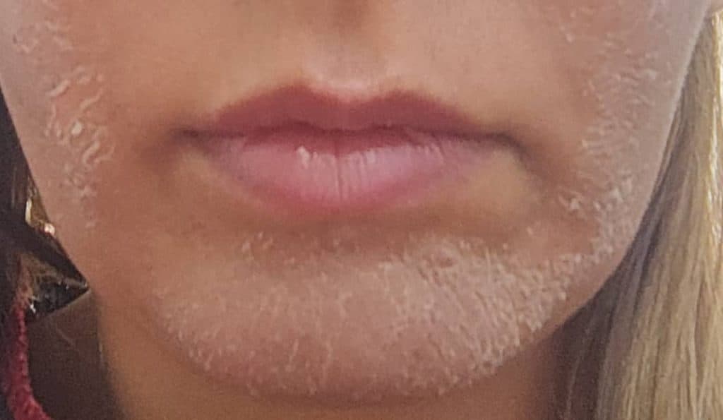 فشیال تخصصی پوست آرتیسا در فسا