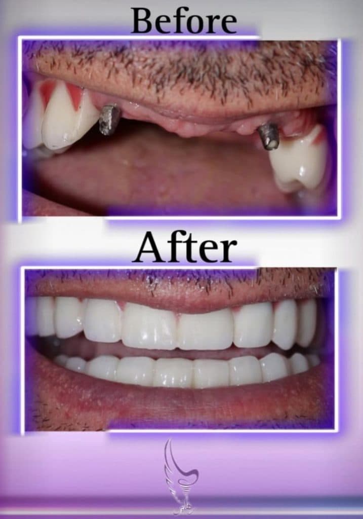 دکتر فراز تیموری متخصص جراحی اوه و ایمپلنت در تهران