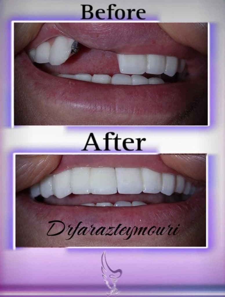 دکتر فراز تیموری متخصص جراحی اوه و ایمپلنت در تهران