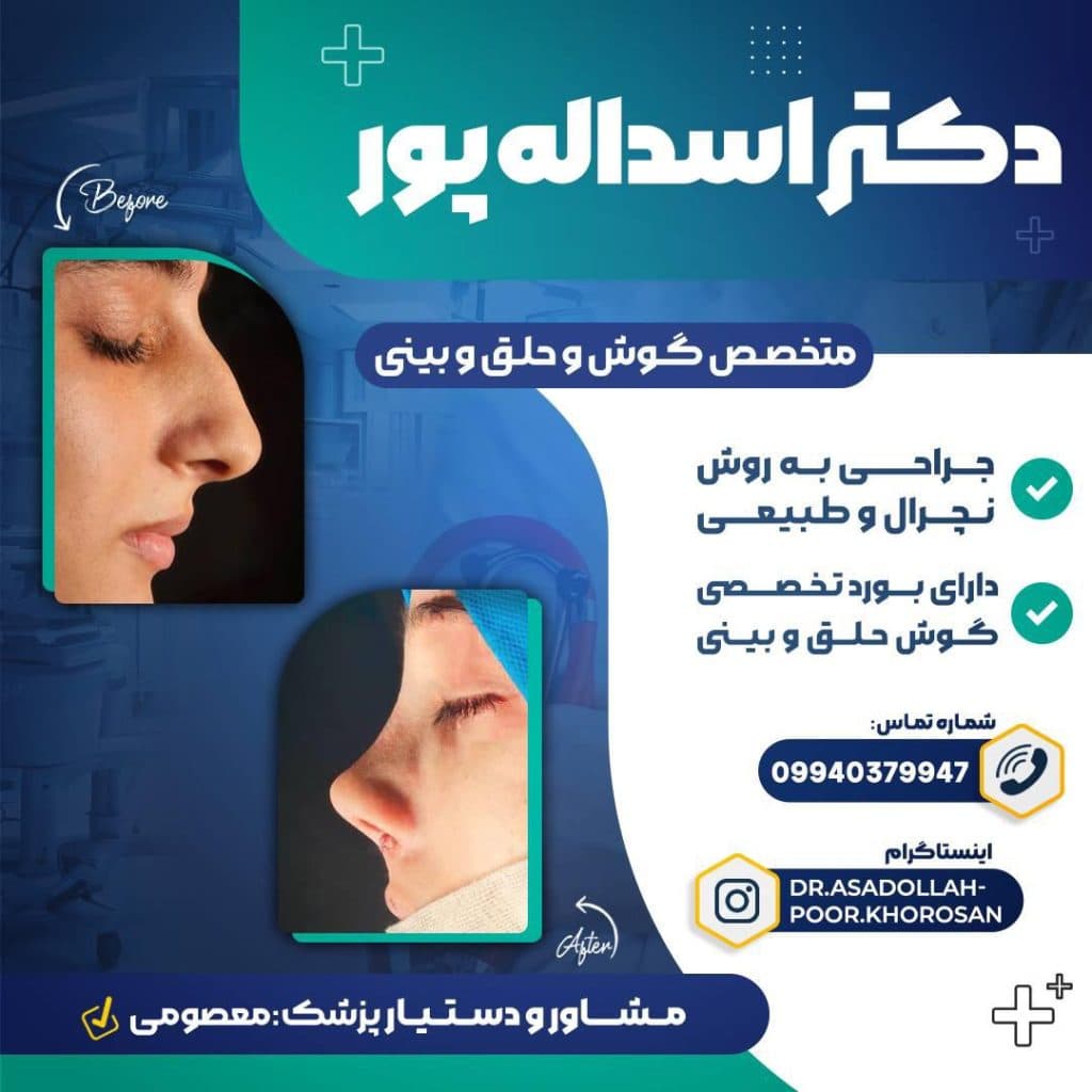 جراحی زیبایی بینی دکتر امیرحسین اسداله پور در قائمشهر