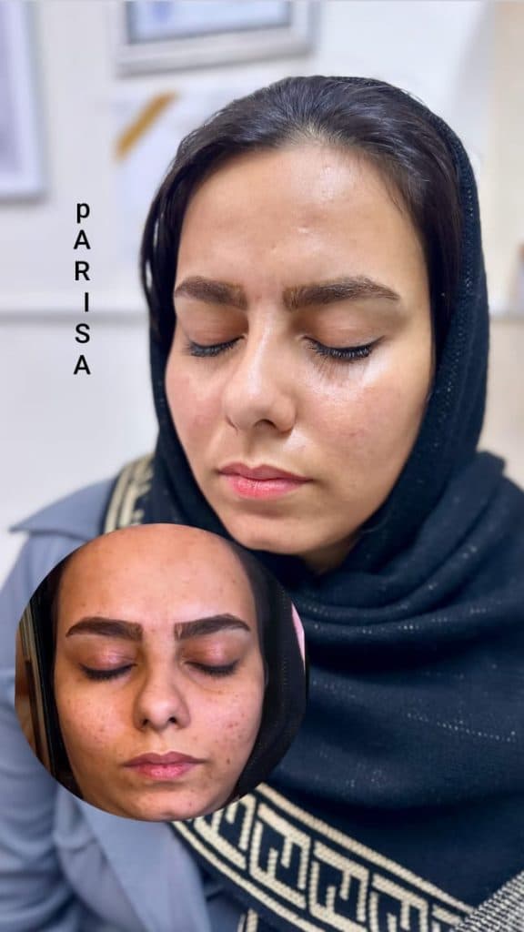 آموزش خدمات پاکسازی و فیشیال پوست پریسا رضائی در بروجرد