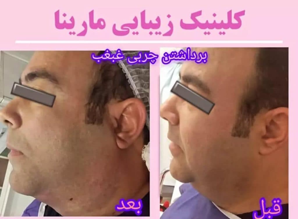 کلینیک زیبایی پوست و مو مارینا در عفیف آباد شیراز
