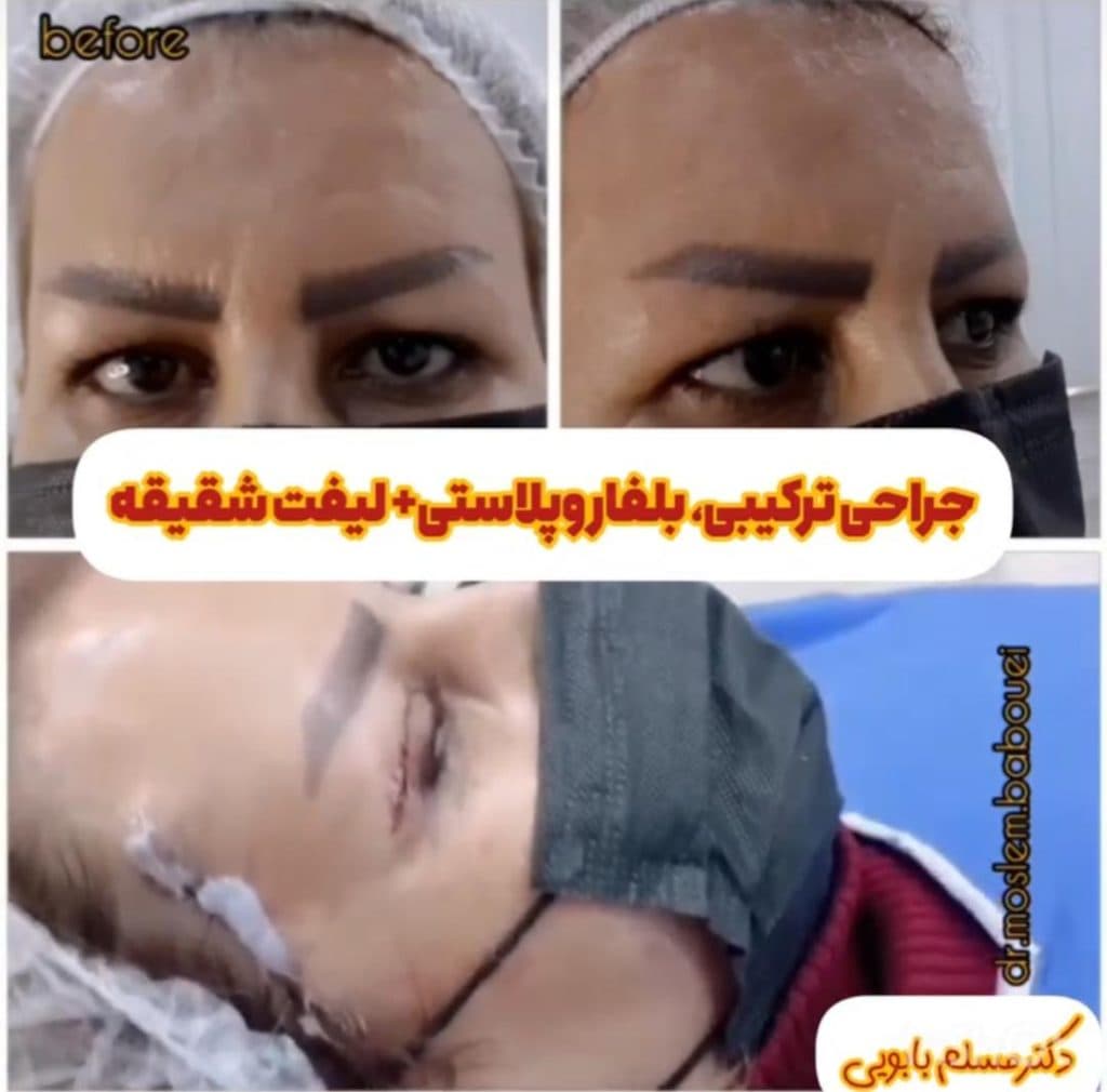 مطب زیبایی دکتر بابویی در منتظری بندر ماهشهر