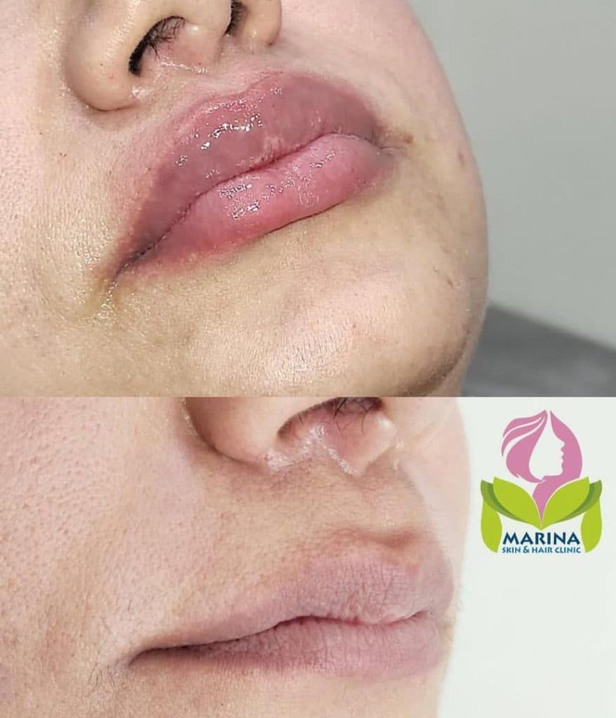 کلینیک زیبایی پوست و مو مارینا در عفیف آباد شیراز