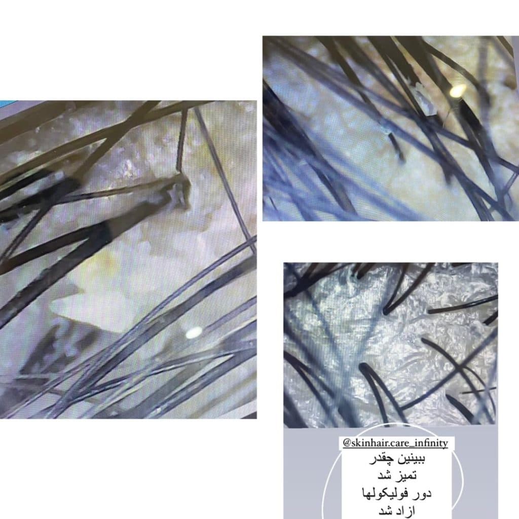 آموزش و خدمات اسکراب شقایق رضازاده در صارمی مشهد