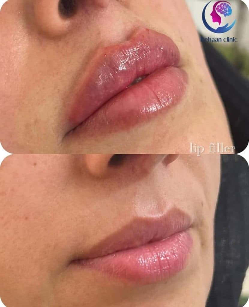 کلینیک تخصصی زیبایی لاغری بهان در آمل