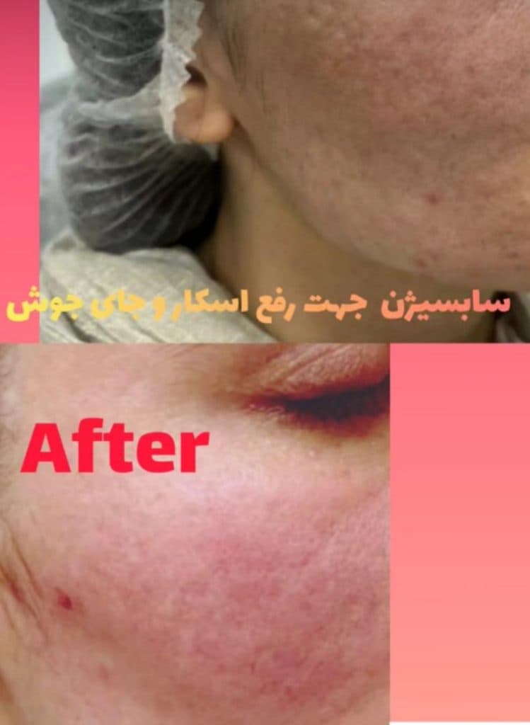 کلینیک زیبایی پوست و مو مارینا در عفیف آباد شیراز