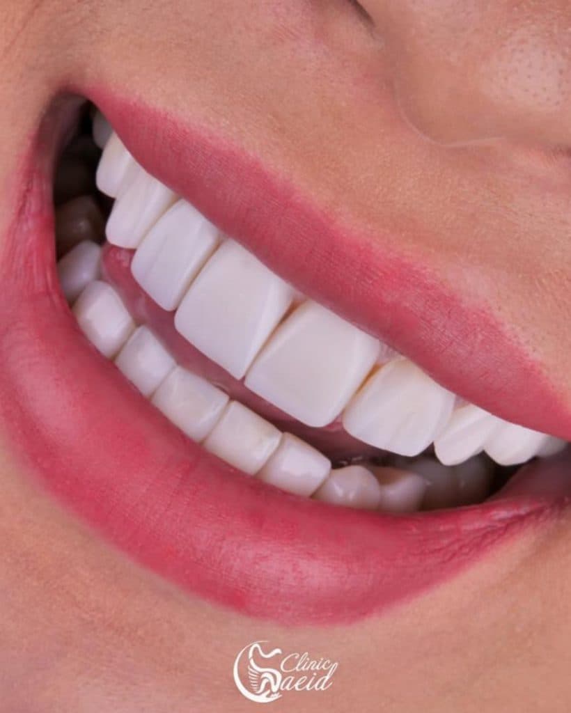 کلینیک دندانپزشکی سعید در احمدآباد مشهد