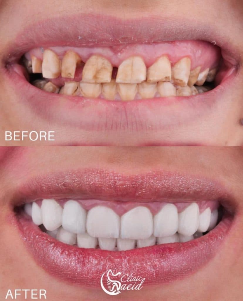 کلینیک دندانپزشکی سعید در احمدآباد مشهد