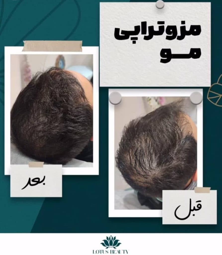 مرکز زیبایی و لاغری لوتوس در نجف آباد