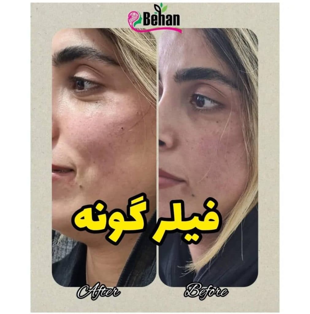 کلینیک تخصصی زیبایی لاغری بهان در آمل