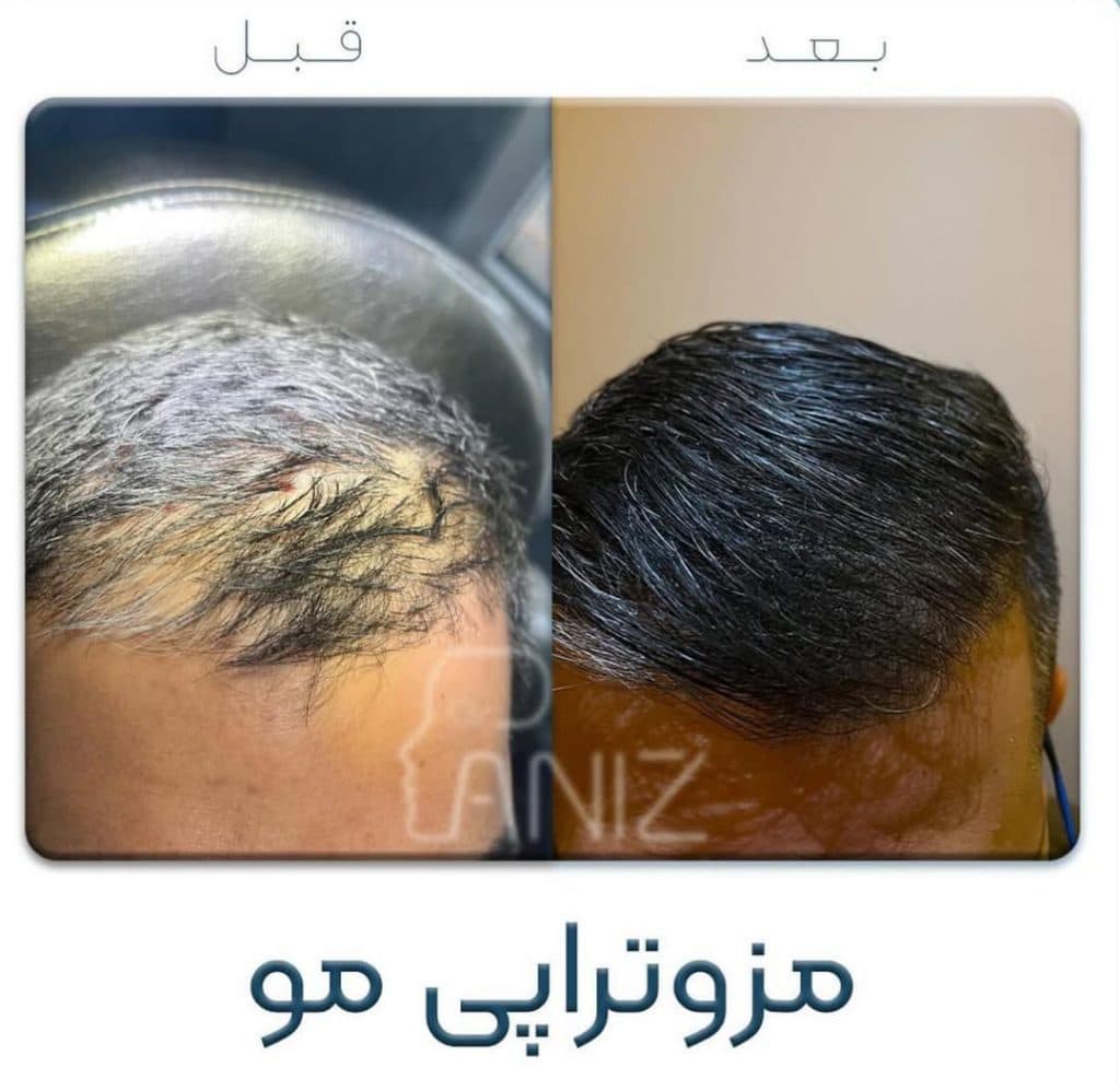 مطب زیبایی دکتر پانیذ شفیقی در ولیعصر تهران