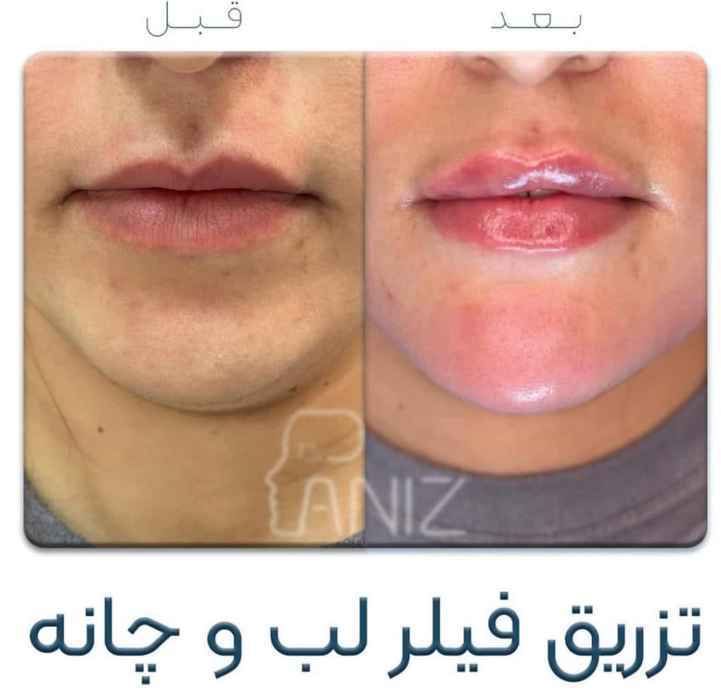 مطب زیبایی دکتر پانیذ شفیقی در ولیعصر تهران