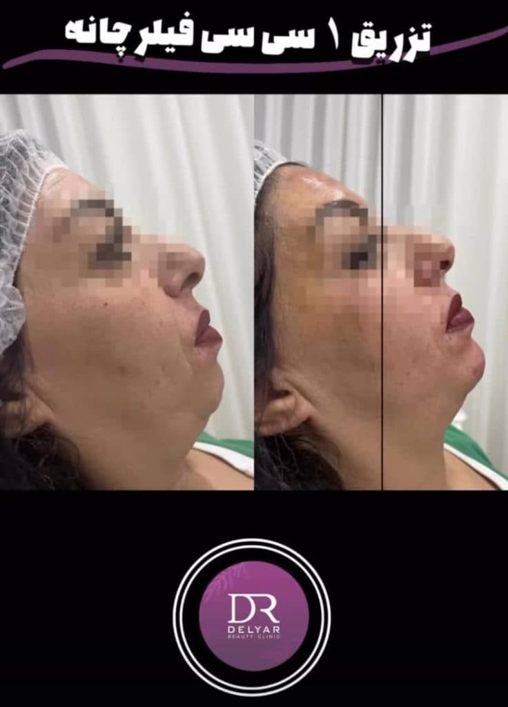 کلینیک زیبایی پوست و مو دلیار در زنجان