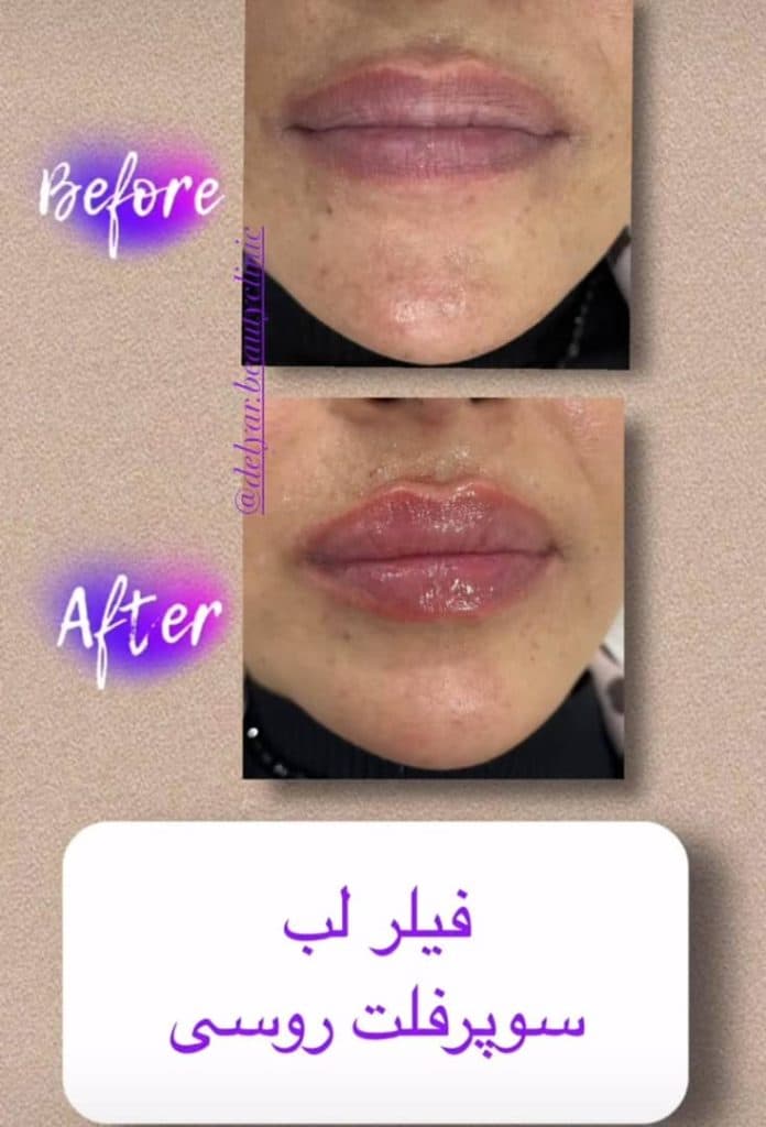 کلینیک زیبایی پوست و مو دلیار در زنجان