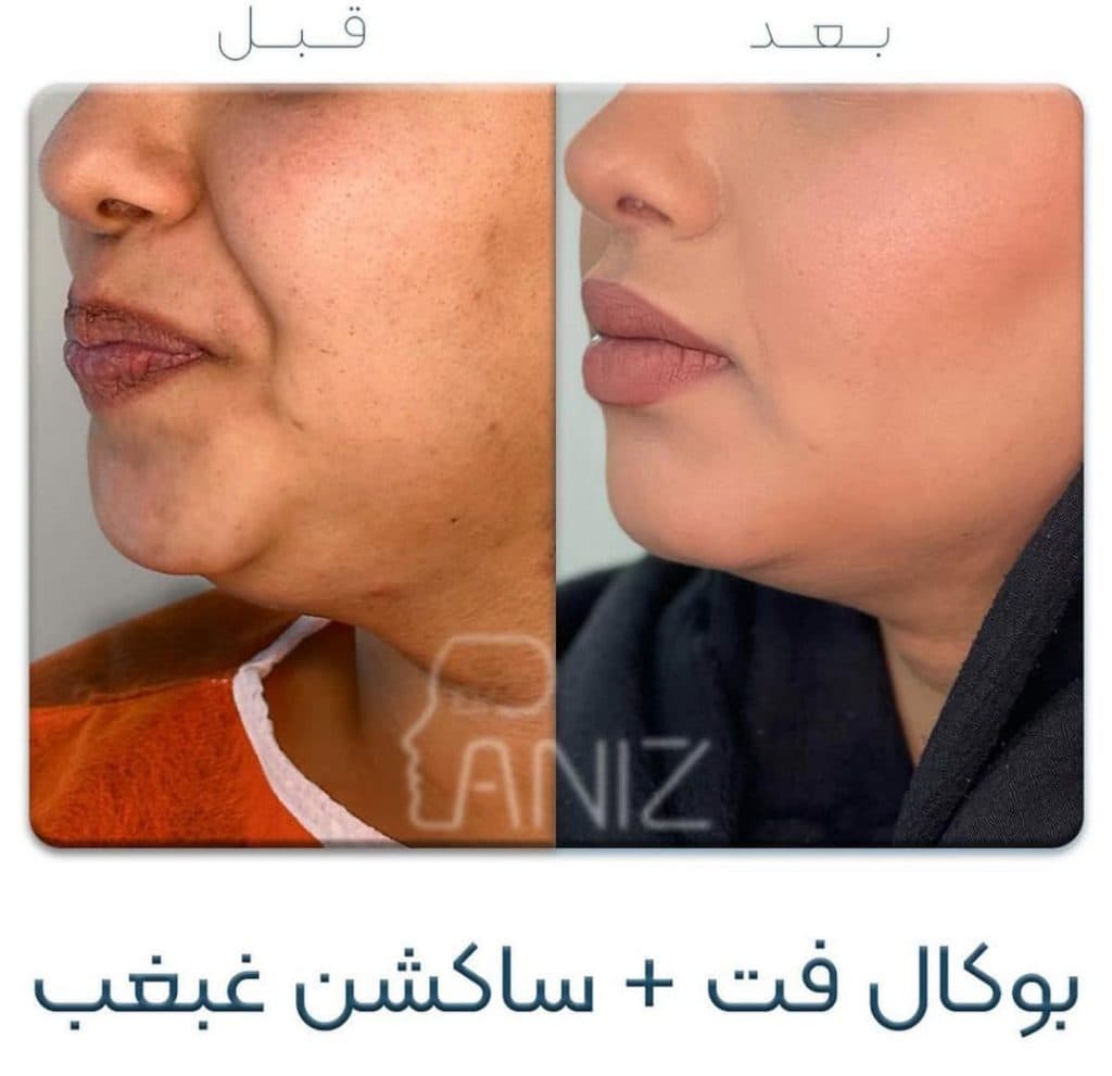 مطب زیبایی دکتر پانیذ شفیقی در ولیعصر تهران