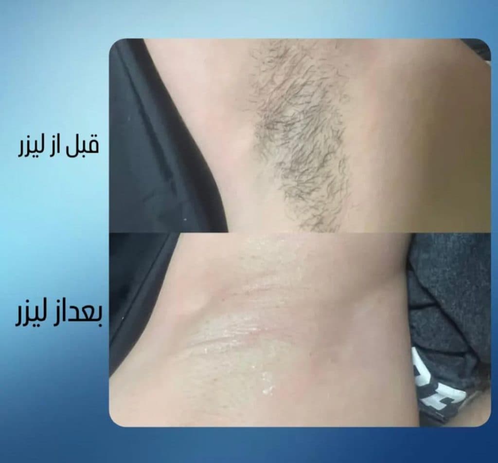 مرکز لیزر الکس کندلا حنا در ستارخان شیراز