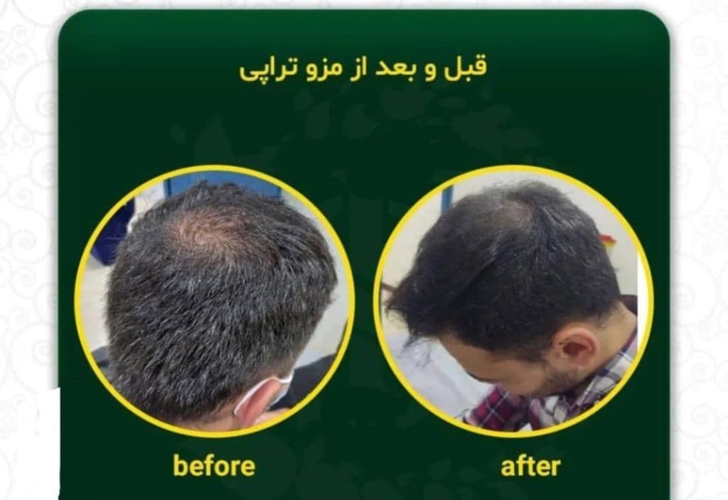 مرکز زیبایی و لیزر موهای زائد لیدا لیزر در بابل