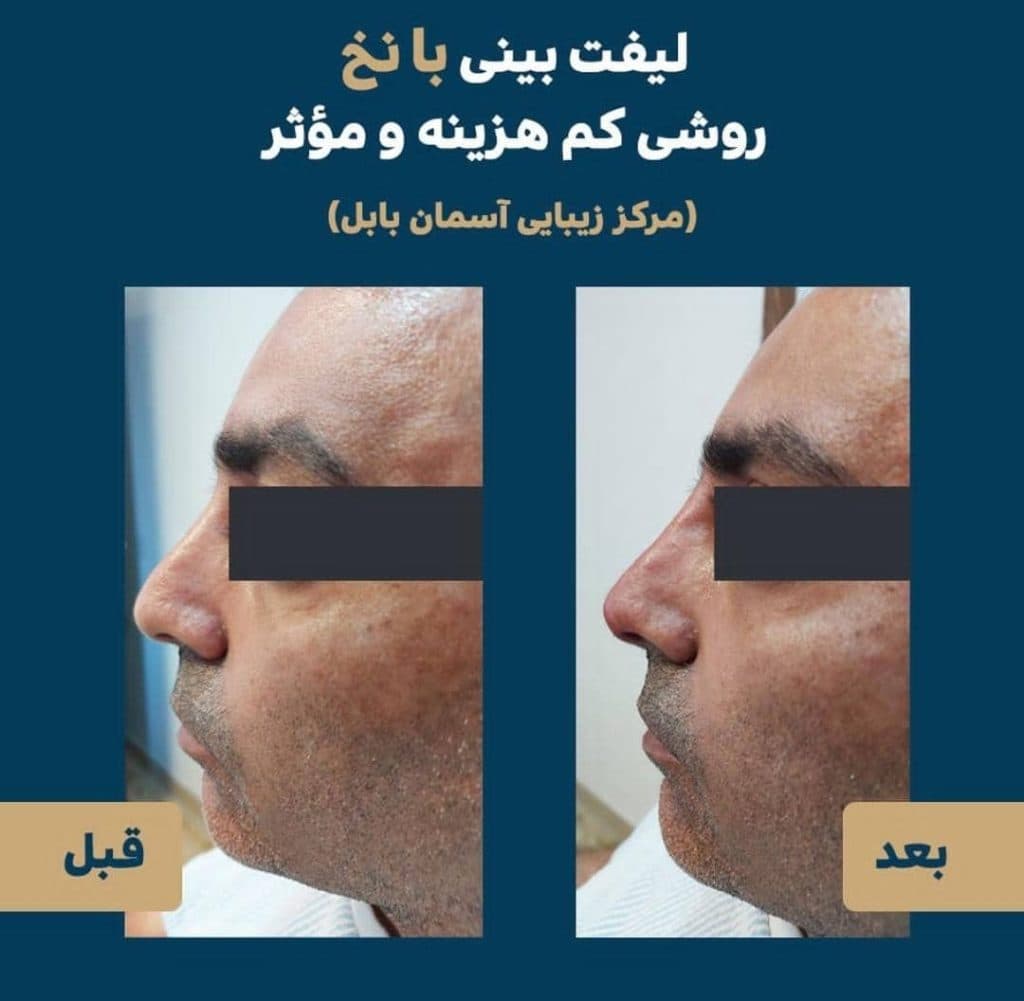 مرکز زیبایی و لیزر موهای زائد لیدا لیزر در بابل