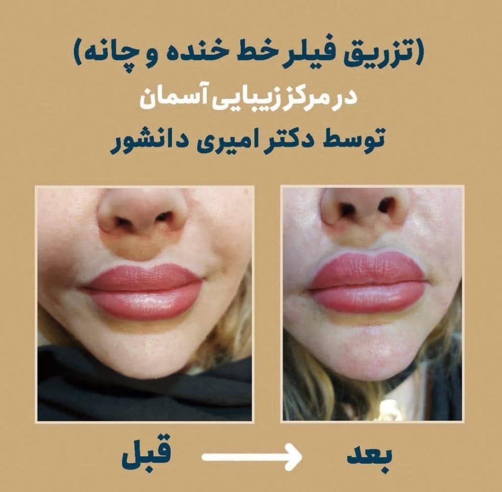 مرکز زیبایی و لیزر موهای زائد لیدا لیزر در بابل