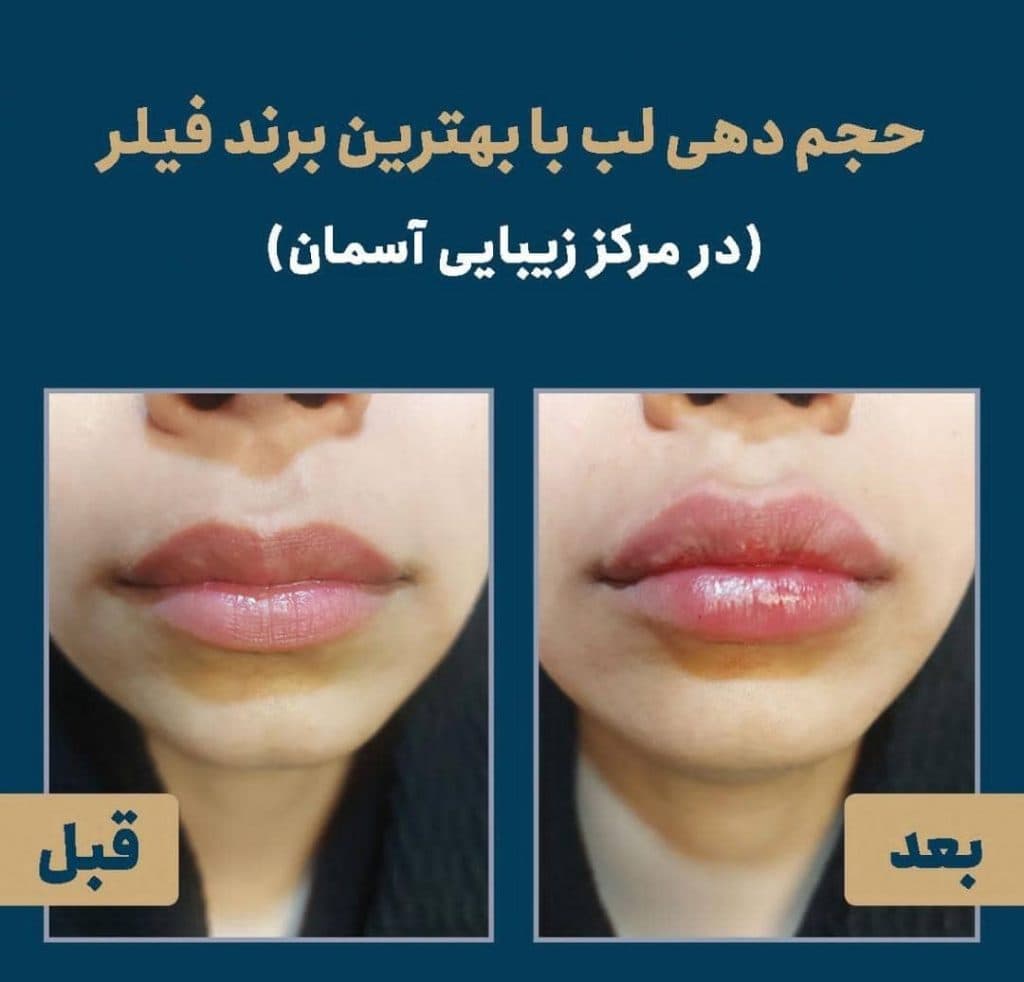 مرکز زیبایی و لیزر موهای زائد لیدا لیزر در بابل