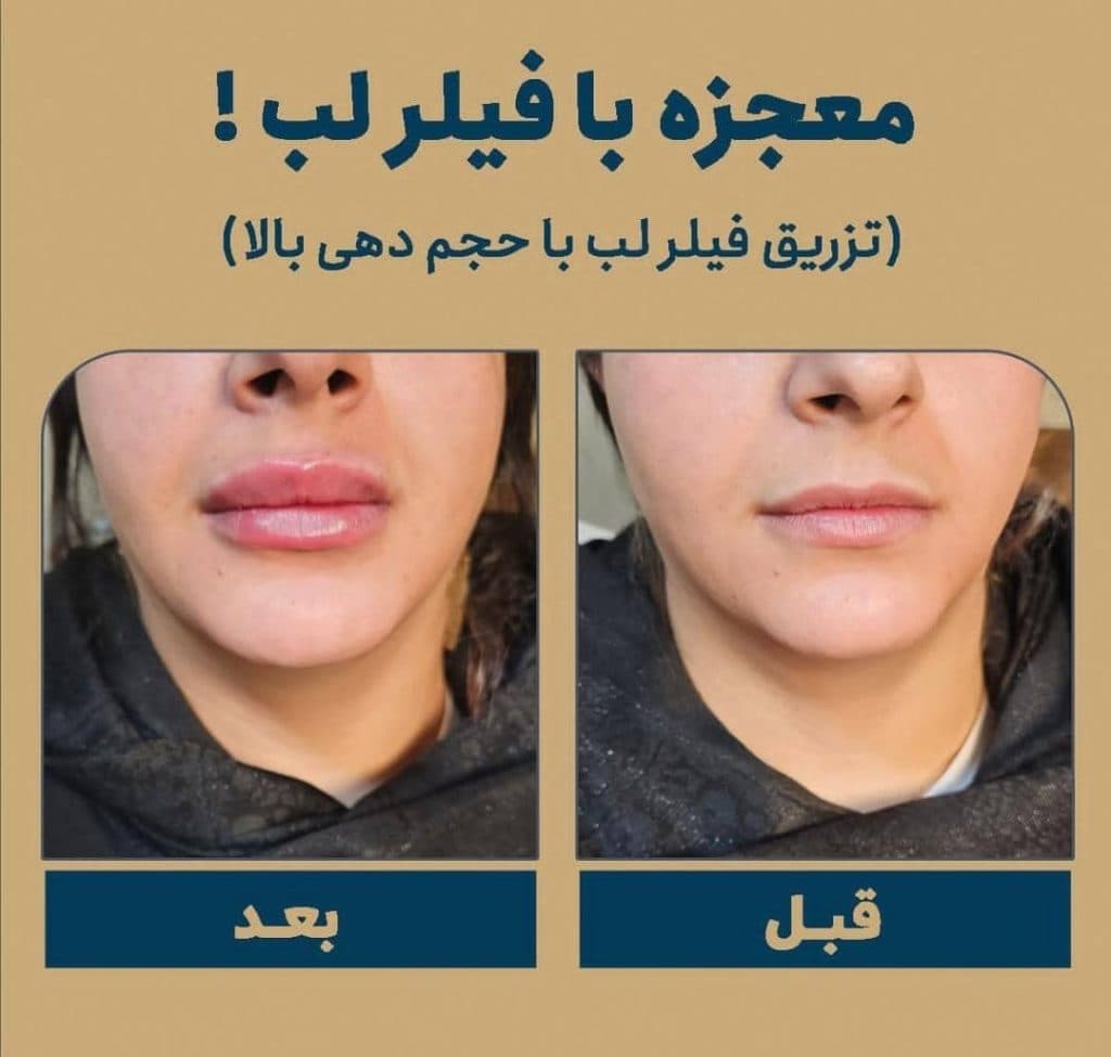 مرکز زیبایی و لیزر موهای زائد لیدا لیزر در بابل